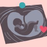 Es gibt verschiedene Tipps zur Vorbereitung für die Geburt